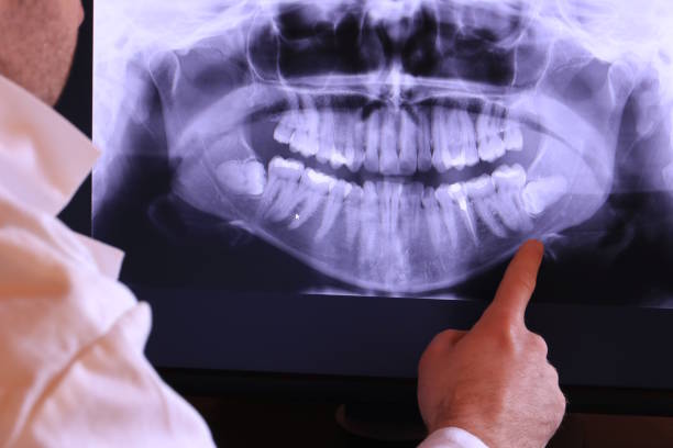 Best Emergency Treatment for Jaw Pain or Injury in Roseland, NJ