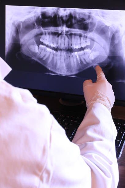 Best Emergency Treatment for Oral Infections in Roseland, NJ