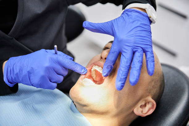 Best Lost Filling or Crown Replacement in Roseland, NJ